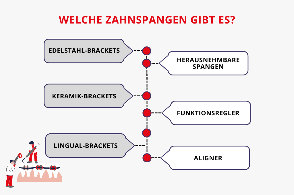 Was kostet eine Zahnspange, verschiedene Arten von Spangen